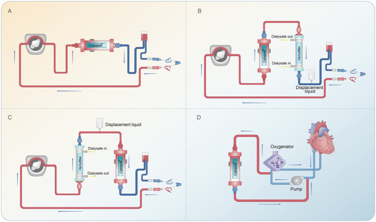 The use of CytoSorb hemoadsorption in critically ill patients: a narrative review.