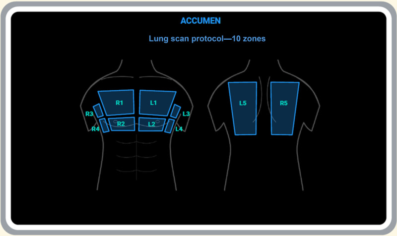Aiding Chronic Obstructive Pulmonary Disease and Congestive Heart Failure Ultrasound-Guided Management Through Enhanced Point-of-Care Ultrasound (ACCUMEN-POCUS): Protocol for a Randomized Controlled Trial.