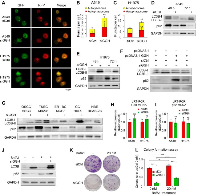 Silencing GGH induces autophagy by increasing folate stress and production of NADH.