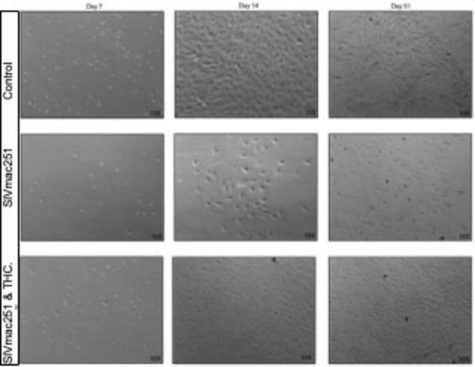THC reverses SIV-induced senescence in astrocytes: possible compensatory mechanism against HIV associated brain injury?