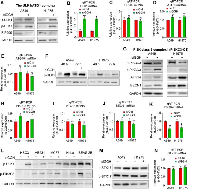 Silencing GGH induces autophagy by increasing folate stress and production of NADH.