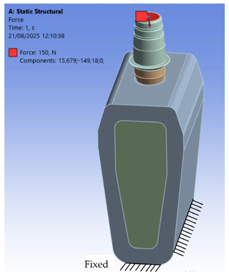 The Effect of Varying Abutment Heights on Stress Distribution in Different Bone Densities: A Finite Element Analysis Study.