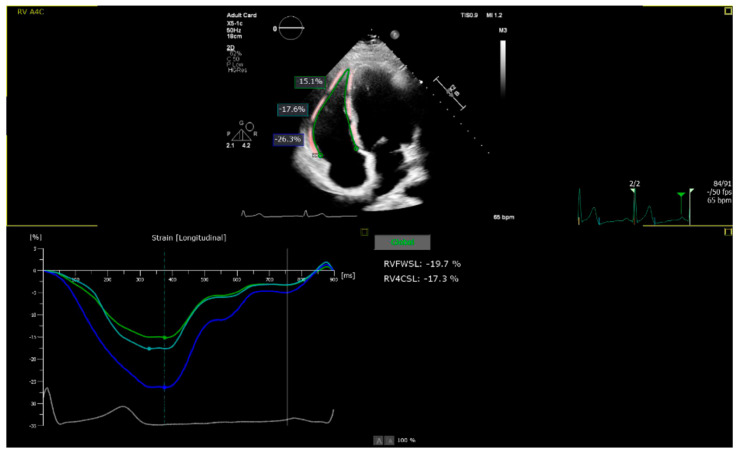 Relationship Between Right Ventricular Function and Body Composition in Adolescents and Young Adults.