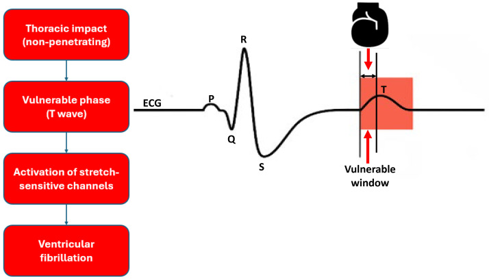 Commotio Cordis in Sudden Cardiac Death in the Young: A State-of-the-Art Review.