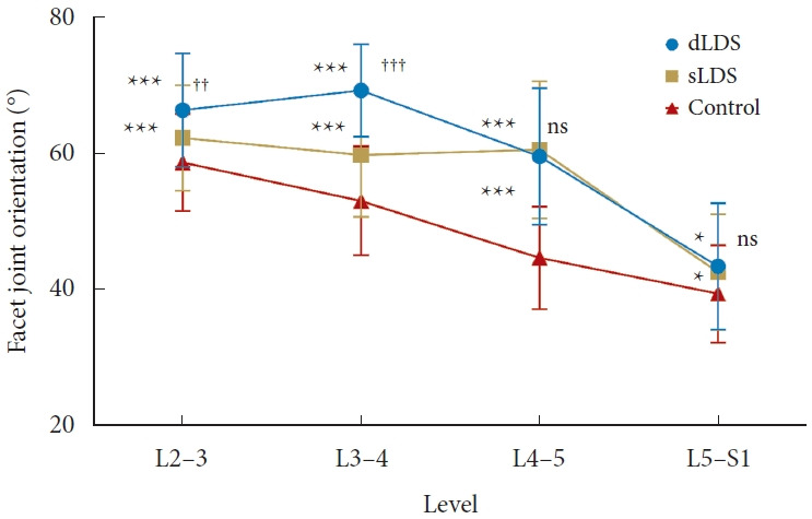 Association Between Facet Joint Orientation and Degenerative Spondylolisthesis: A Radiological Study of Double-Level Versus Single-Level Degenerative Spondylolisthesis.