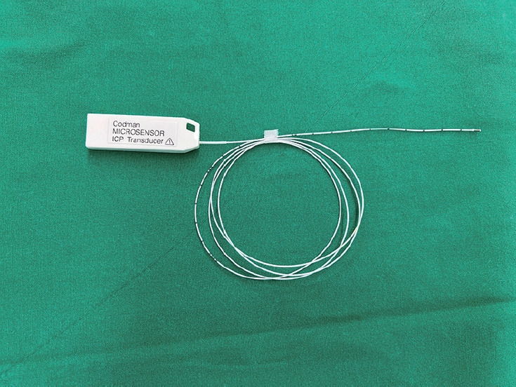Real-Time Water Pressure Monitoring in Unilateral Biportal Endoscopic Spine Surgery.
