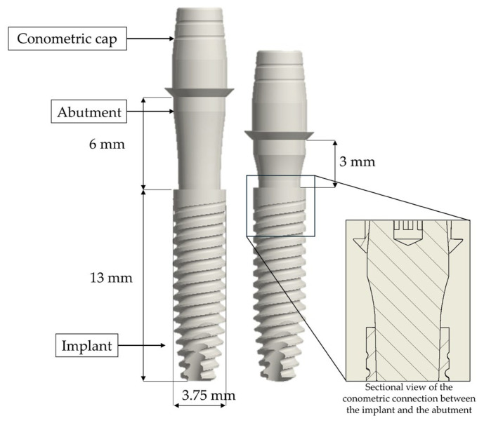 The Effect of Varying Abutment Heights on Stress Distribution in Different Bone Densities: A Finite Element Analysis Study.