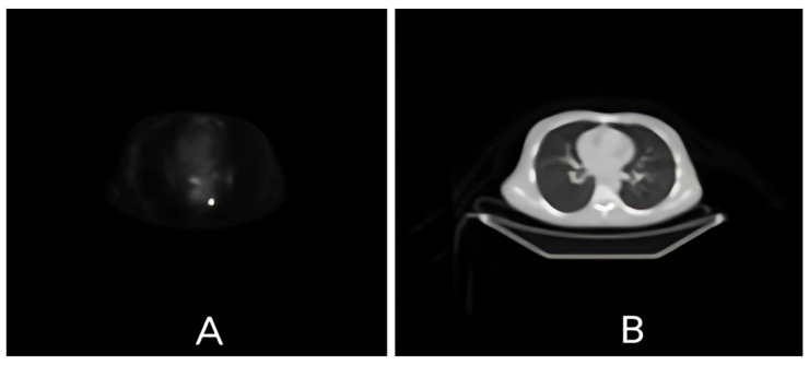 Optimising Multimodal Image Registration Techniques: A Comprehensive Study of Non-Rigid and Affine Methods for PET/CT Integration.