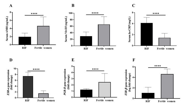 Endometrial Steroid Receptor Dysregulation and Its Association with Vitamin D, AMH, and Inflammation in Recurrent Implantation Failure: A Case-Control Study.