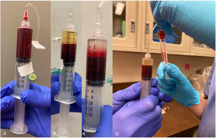 A Method for Processing Whole Blood for Heterologous Packed Red Blood Cell Transfusion for Use in a Green-Winged Macaw (Ara chloropterus).