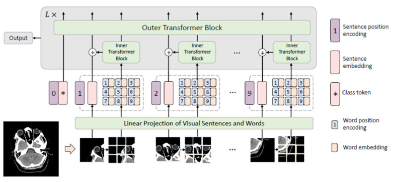 Brain Stroke Classification Using CT Scans with Transformer-Based Models and Explainable AI.