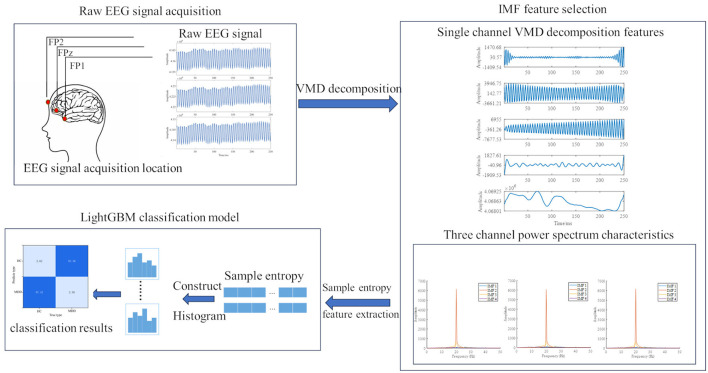A novel fast detection algorithm for depression based on 3-channel EEG signals.
