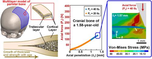 A multilayer, anisotropy-aware, age-dependent finite element framework for pin-skull indentation mechanics with implications for pediatric cranial safety