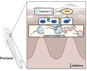 Loss of Galectin-3 in the epidermis exacerbates psoriasis pathogenesis via inhibiting autophagy