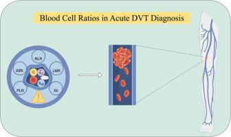 Association between inflammation‑based index and acute deep vein thrombosis and thrombus burden