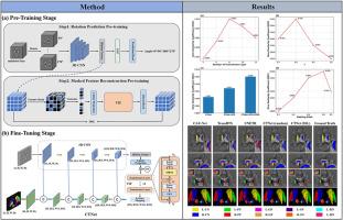 Self-supervised pre-training based hybrid network for deep gray matter nuclei segmentation
