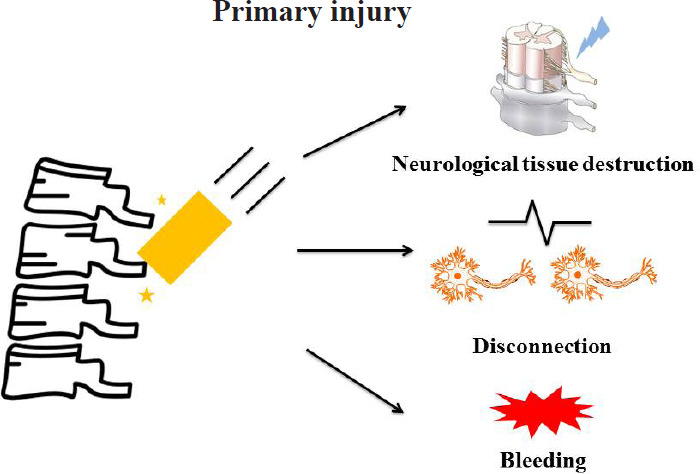 Application of hyperbaric oxygen therapy in the treatment of spinal cord injury: insights from preclinical to clinical evidence.