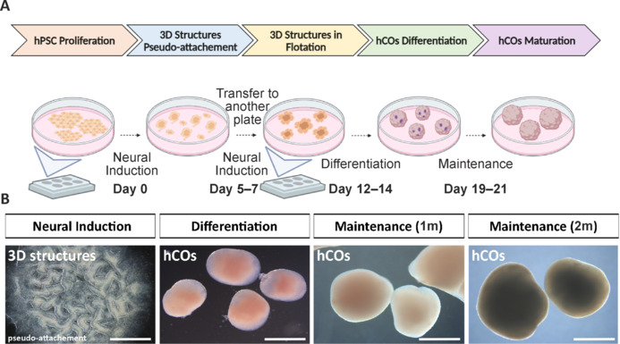 Human cerebral organoids: Complex, versatile, and human-relevant models of neural development and brain diseases.