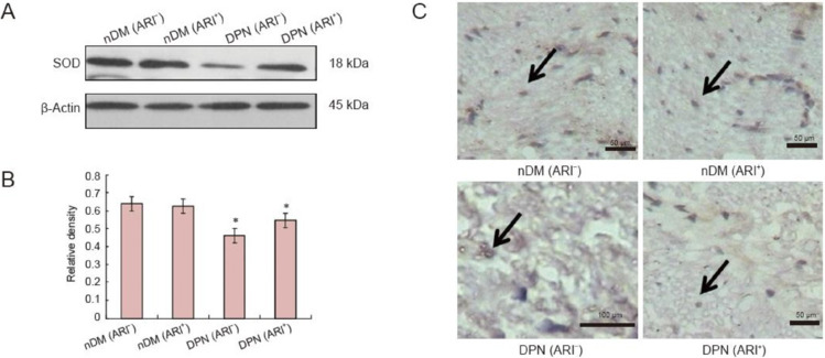 Corrigendum: Epalrestat protects against diabetic peripheral neuropathy by alleviating oxidative stress and inhibiting polyol pathway.