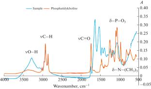 Determination of Phospholipids in Infant Formula Using Infrared Spectroscopy and Chemometric Data Analysis