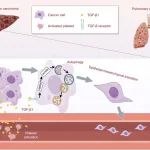 Cancer Letters | 华中科技大学明章银教授团队揭示血小板来源的TGF-β1诱导自噬促进原位肝癌转移的新机制