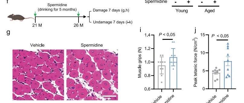 【科技前沿】Cell Discov｜李虎/张勇/朱大海团队揭示亚精胺抗衰老新机制，激活肌肉干细胞，改善衰老的肌肉功能