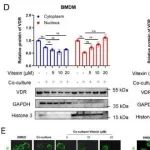 Mol Cancer | 中山大学唐海林等团队发现牡荆素作为一种新的VDR激动剂，可减轻慢性肠道炎症向结直肠癌的转变