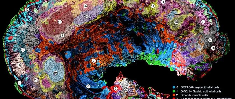 Cell｜樊荣团队开发全球首个临床级FFPE样本空间全转录组测序技术