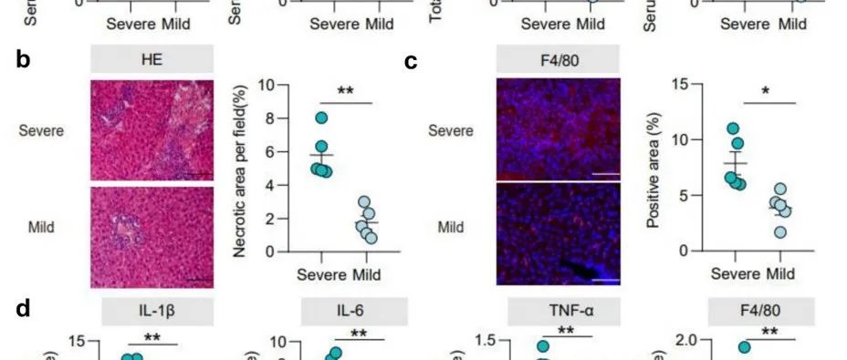 Gut Microbes | 陆军军医大学杨仕明/唐波揭示嗜酸乳杆菌通过抑制胆汁酸合成和促进胆汁酸排泄改善胆汁淤积性肝损伤