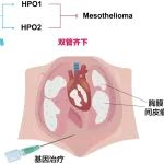 Cell Reports Med | 复旦大学余发星团队报道胸膜间皮瘤基因治疗新策略