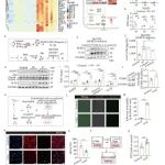 Protein & Cell | 中国医学科学院鲍琳琳揭示巨噬细胞通过NLRP3信号通路分泌的Lcn2引发重症肺炎