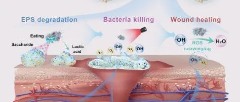 文献分享 | Adv. Mater. | 通过“吞食”细胞外聚合物促进伤口再生，具有抗生物膜形态的工程益生菌异质结