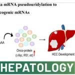 Hepatology丨中山大学肖振东团队发现假尿嘧啶合成酶1通过mRNA假尿嘧啶化促进肝癌，增强致癌mRNA的翻译