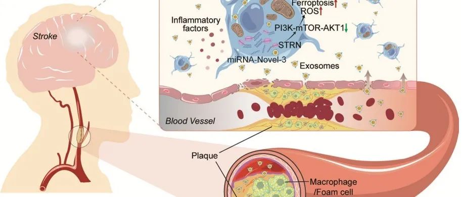Nature子刊 | 华中科技大学田代实/王伟/秦川揭示了一种外泌体调节参与神经炎症加剧缺血性脑损伤新机制！