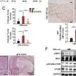 PNAS | 徐州医科大学白津等团队表明FBXO22通过调节mTOR的s2448磷酸化形式的降解来抑制结肠炎和结直肠癌发生