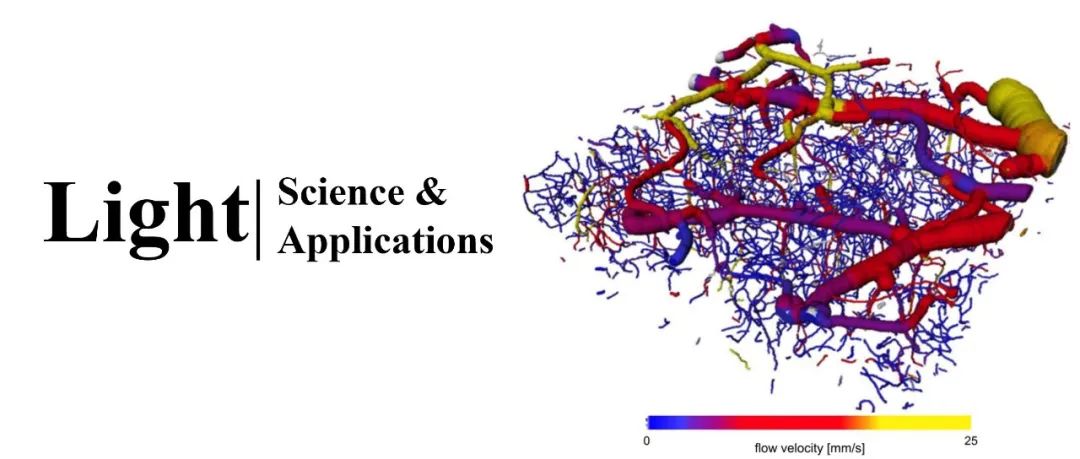 Light | 贝塞尔光束光学相干显微镜：多尺度评估脑血管网络形态及功能