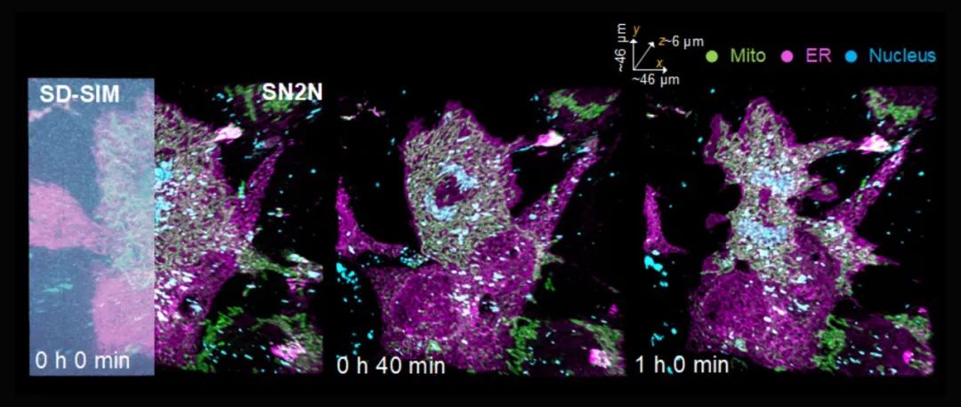 Nature Methods | 自启发学习超分辨去噪方法