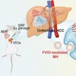 ACS Nano：胞内磁热疗法可通过增强铁死亡实现原位肝细胞癌化疗增敏