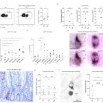 Gut Microbes | 生孢梭菌产生的代谢产物保护小鼠免受结肠炎的侵袭