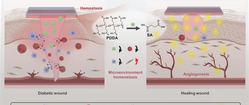 华科大罗亮/田斯丹/孟凡玲 Nat. Commun.：基于可降解聚二炔材料的微环境调控型糖尿病伤口敷料