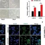 Small丨华中科技大学陈瑞等团队合作研究制备白藜芦醇仿生纳米药调节肿瘤干细胞活性以抑制结直肠癌转移