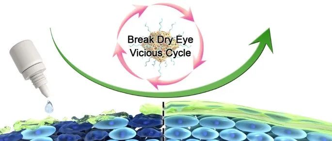 【转载】纳米酶滴眼液为干眼治疗提供新策略