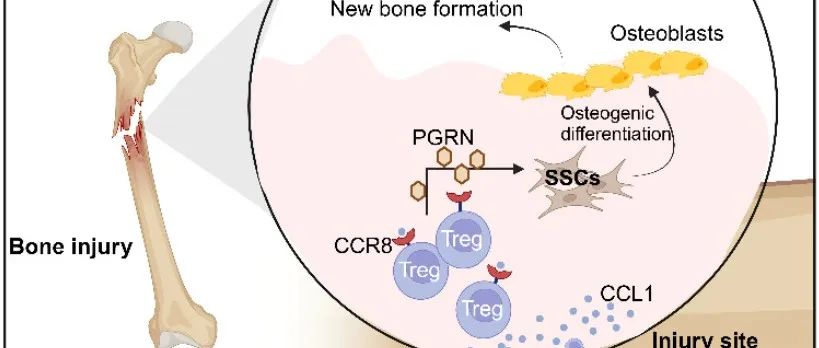 【科技前沿】JCI丨赖红昌课题组、李斌课题组揭示“骨损伤响应型”Treg细胞通过分泌颗粒蛋白前体调控骨骼干细胞功能促进骨损伤修复