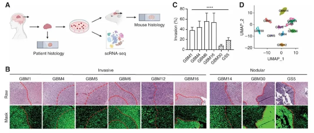 [文献分享]跨平台分析揭示胶质母细胞瘤侵袭的细胞和分子景观