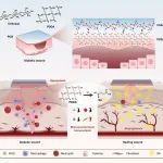 Nat. Rev. Mater. 亮点报道 - 华科大罗亮/田斯丹/孟凡玲：促进糖尿病伤口修复