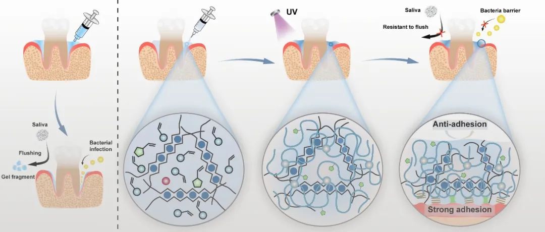 北京化工大学徐福建教授团队 AM：可适应强湿粘附水凝胶用于长期保护牙周炎伤口