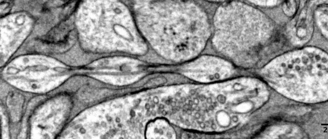 改写百年认知！神经元的基本形态，我们一直弄错了？
