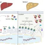 J Hepatol | 范祖森等团队合作发现可读环状RNA RCRIN抑制代谢功能障碍相关的脂肪变性肝病