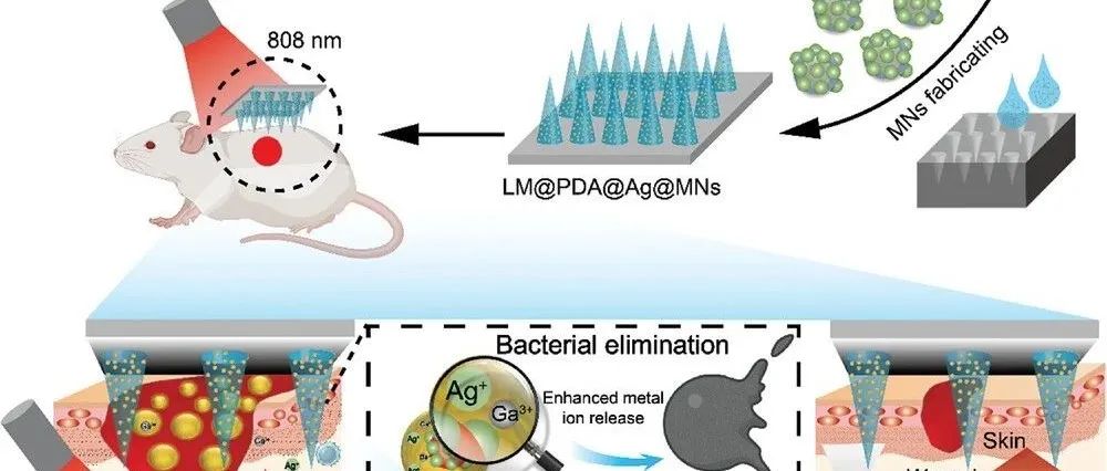 文献分享 | AFunct. Mater. | 基于镓纳米结构的微针贴剂用于多药耐药细菌伤口愈合：增强金属释放和NIR光热效应