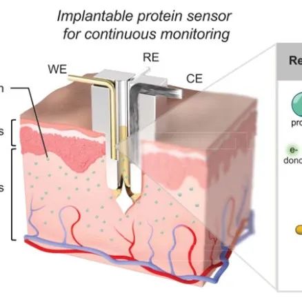 Science | 激活-复位蛋白传感器实现体内炎症的连续监测